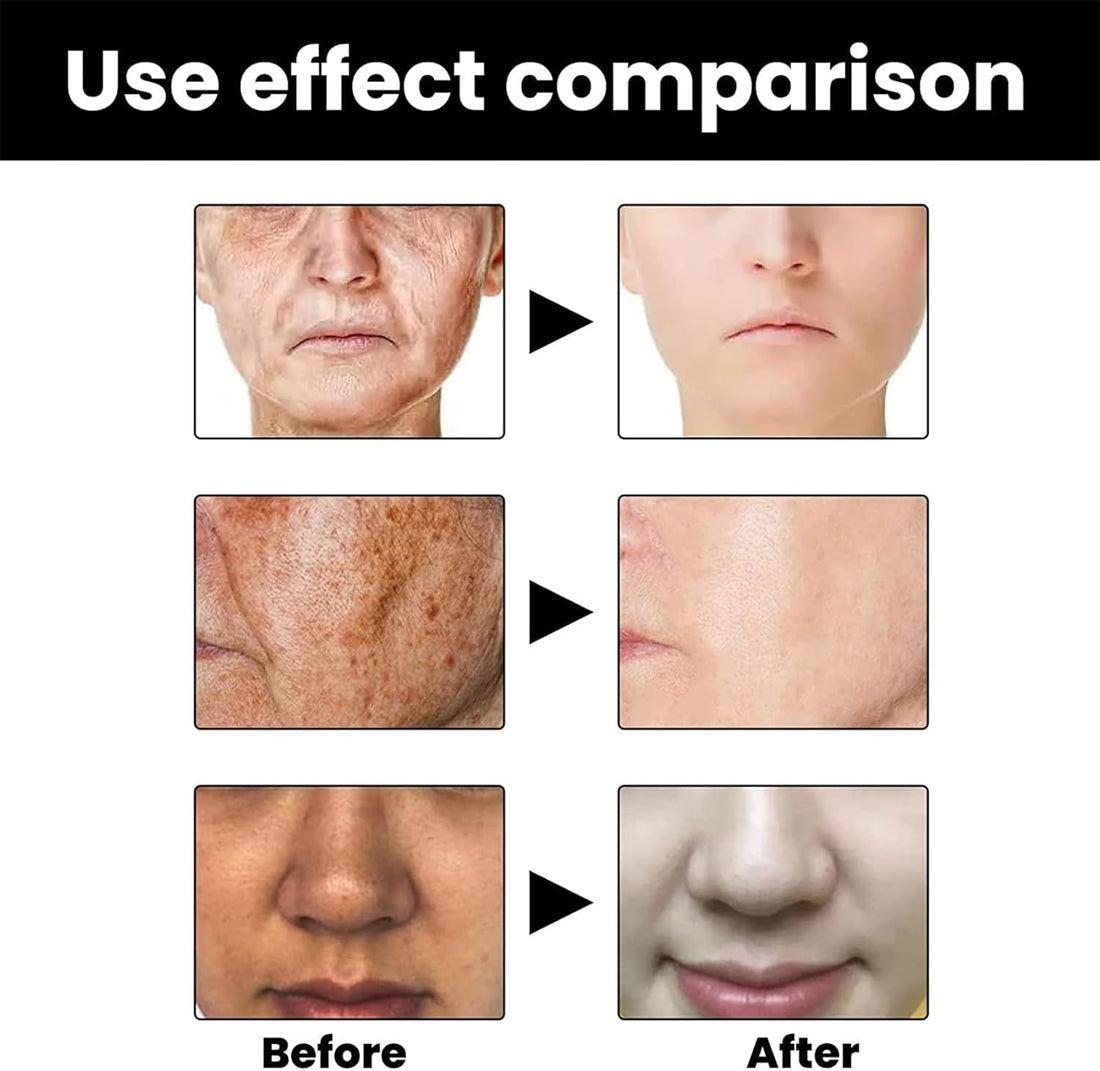 Eelhoe - Melanin Correcting  Serum